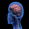 Traumatic Brain Injury